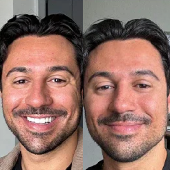 Your Face Is the Billboard of Your Competence. Right Now, It's Lying.