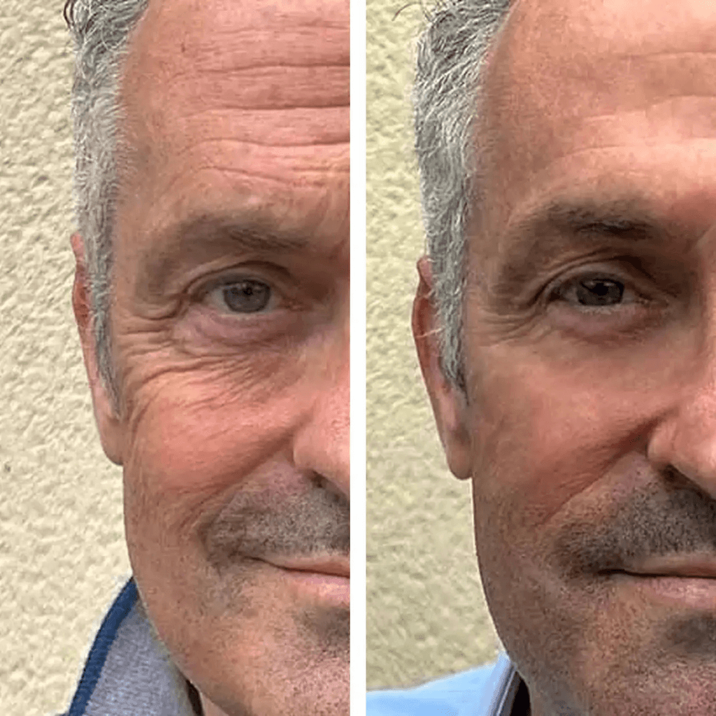 Your Face Is the Billboard of Your Competence. Right Now, It's Lying.